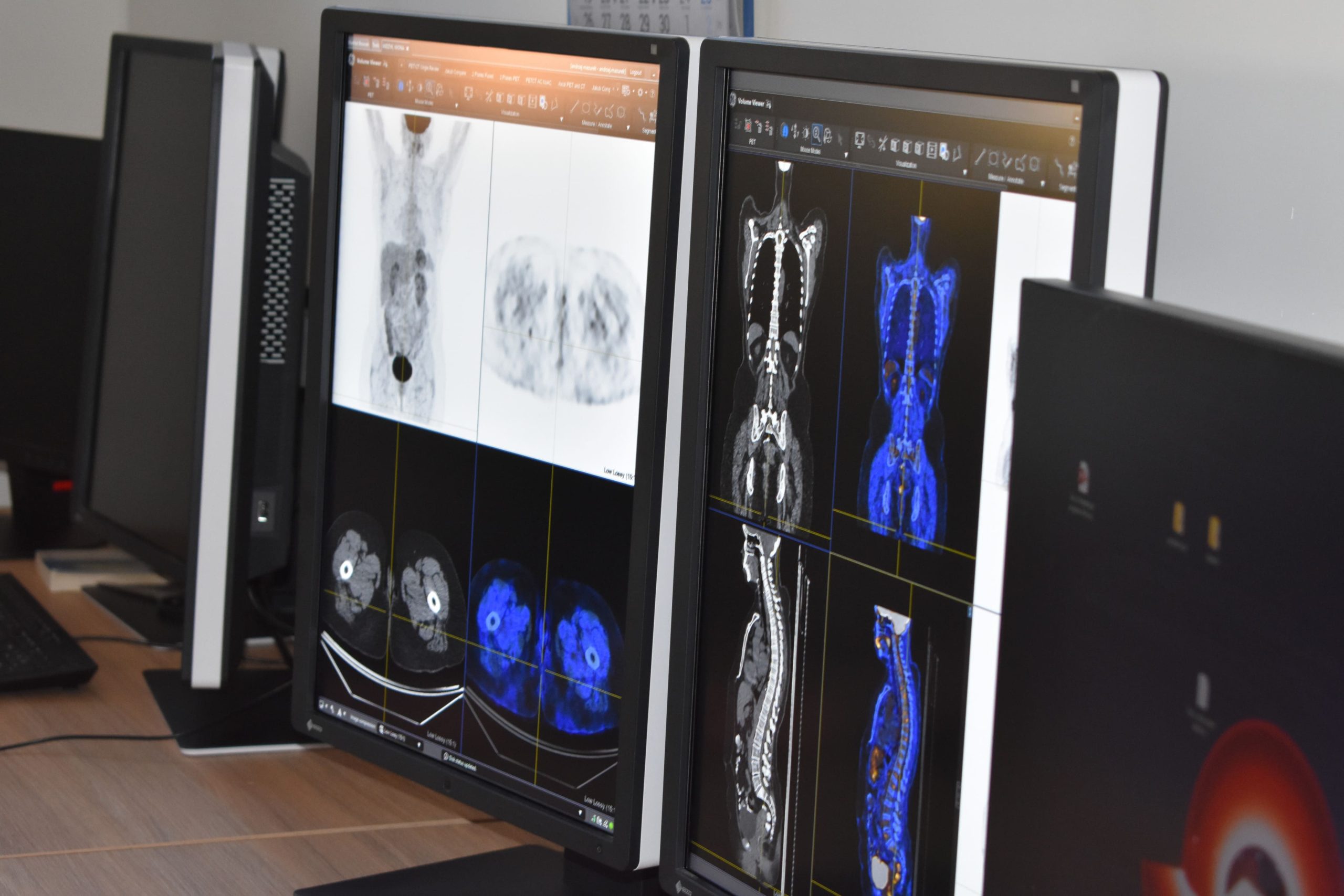 Uroczystość otwarcia nowego skanera PET-CT w Centrum Medycznym Affidea w Wojskowym Instytucie Medycznym
