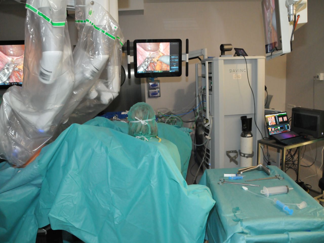 Robotic Workshop – Mastering in Deep Endometriosis - relacja z wydarzenia