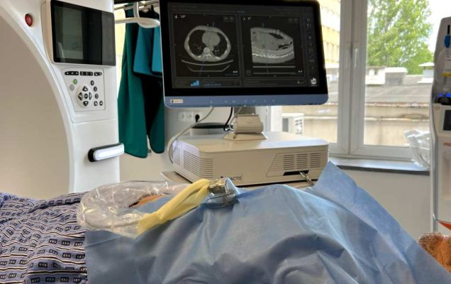 Pomieszczenie medyczne z tomografem komputerowym i monitorem wyświetlającym obrazy skanów. Pacjent leży przykryty niebieskim sterylnym prześcieradłem, a wejście znajduje się po jego stronie.